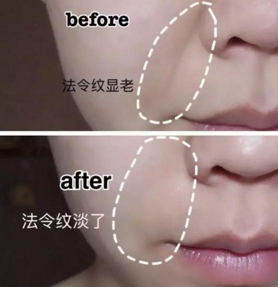 让日本女人夜夜疯狂的神器，法令纹、眉间纹克星！一贴＝10次除皱