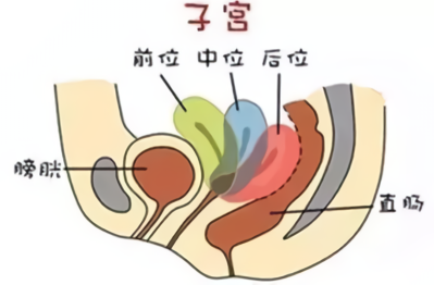 子宫长什么样图片,正常的子宫是什么样的?