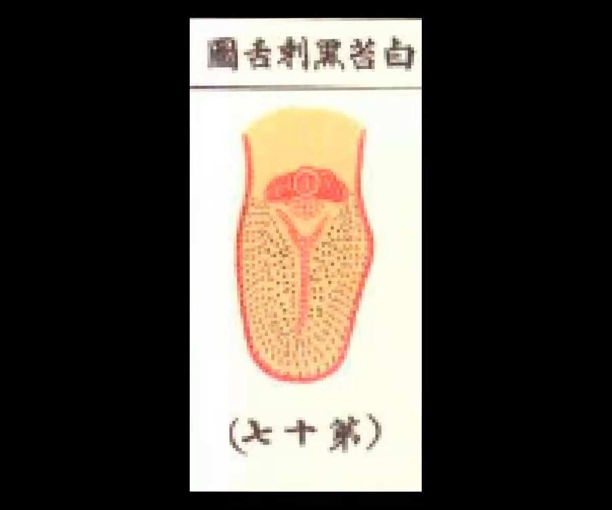 舌头出现黑点白苔症状的原因分析