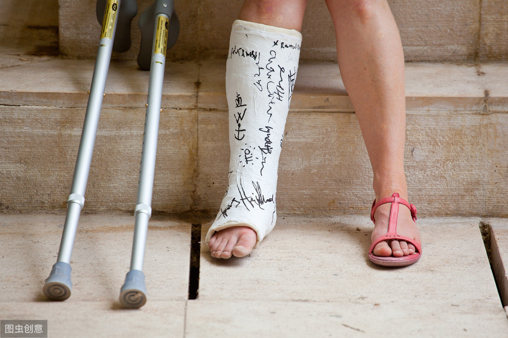 移位和粉碎轻微,应行闭合复位长腿石膏固定,逐渐负重