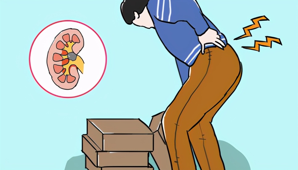 腰疼还是肾疼?医生 1 招教你分辨