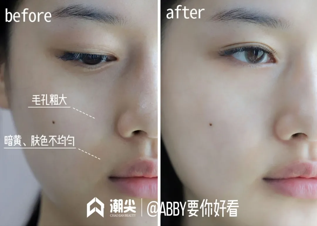 荣晟医用冷敷贴效果怎么样,好用吗