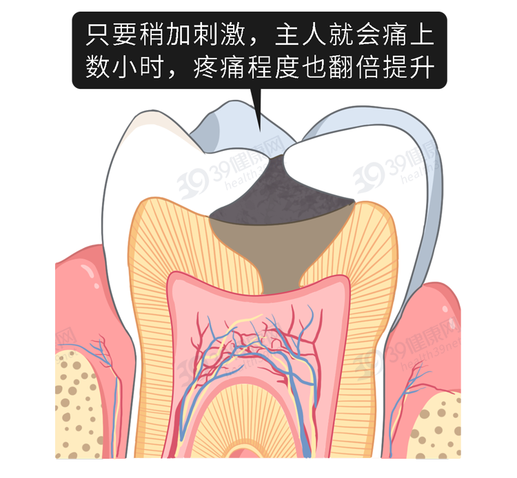 如何护理牙齿，让口腔更健康？记下3个护牙小方法，老了不掉牙