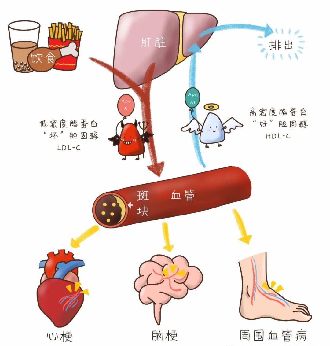 运动后头晕恶心想吐怎么缓解(他汀药物的4个常见副作用)