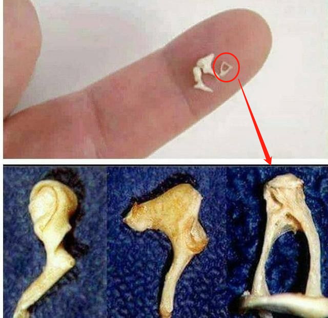 耳鸣、眩晕、听力下降，可能是人体最小的骨头罢工了