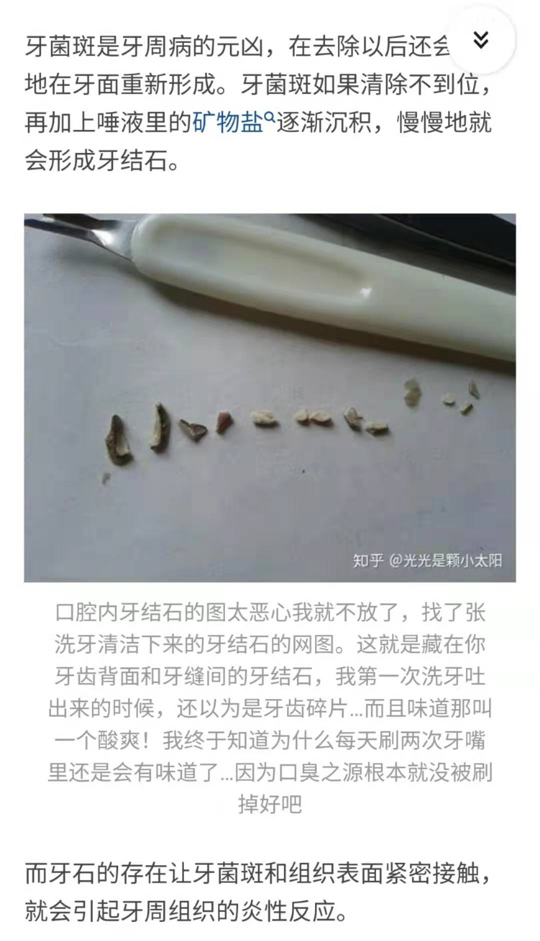 我就是那个被牙疼折磨的女孩