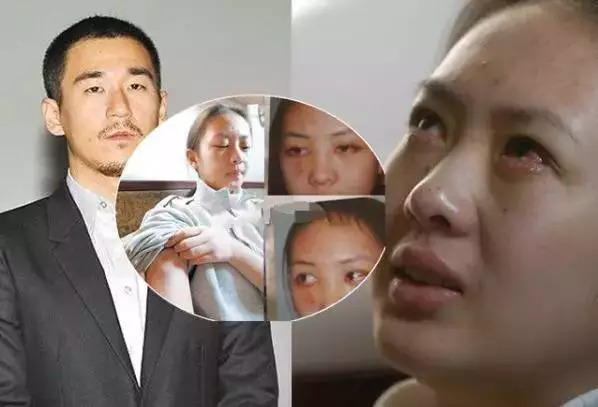 “小章子怡”：为上位被教授强奸，被张国立儿子家暴报复险些丧命