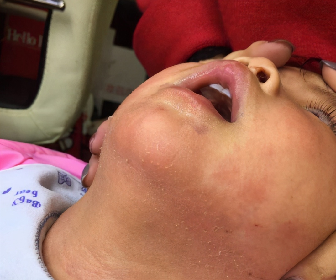 婴儿可以吃鸡蛋羹吗(鸡蛋羹不适合作为宝宝的第一口辅食) - 乐宝宝贝