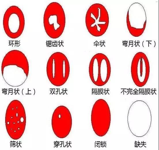 女生的卫生棉条是怎么塞进身体里？