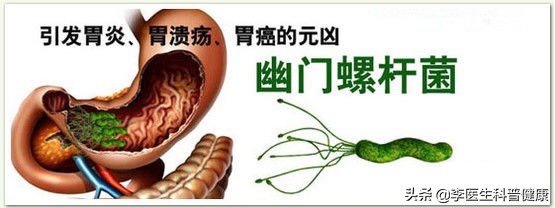 幽门螺旋杆菌感染的治疗方法与根除方案