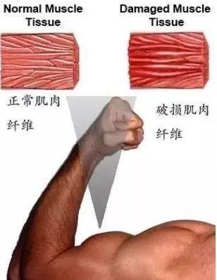 如何緩解健身後的肌肉酸痛？