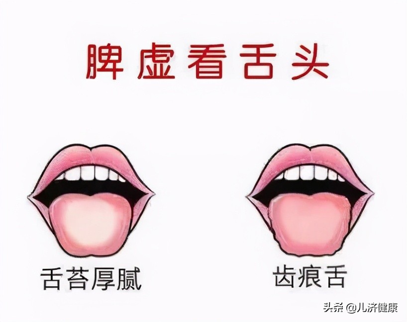 孩子脾虚危害大：中医健脾益气的食疗调理