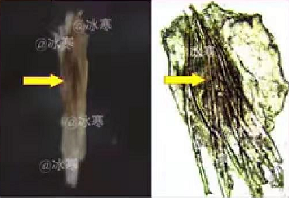 黑头挤了第二天又满了（黑头的清洁步骤和注意事项 ）