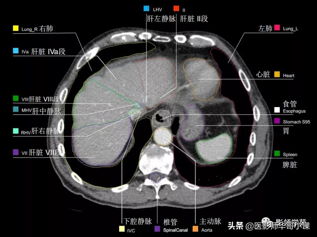 肝ct分段解剖示意图图片
