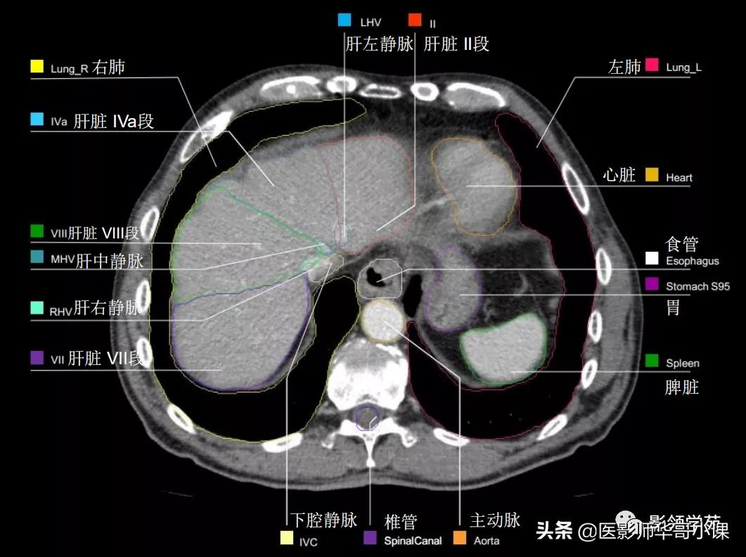 「高清解剖」腹部ct影像学解剖图谱(肝脏分叶分段)