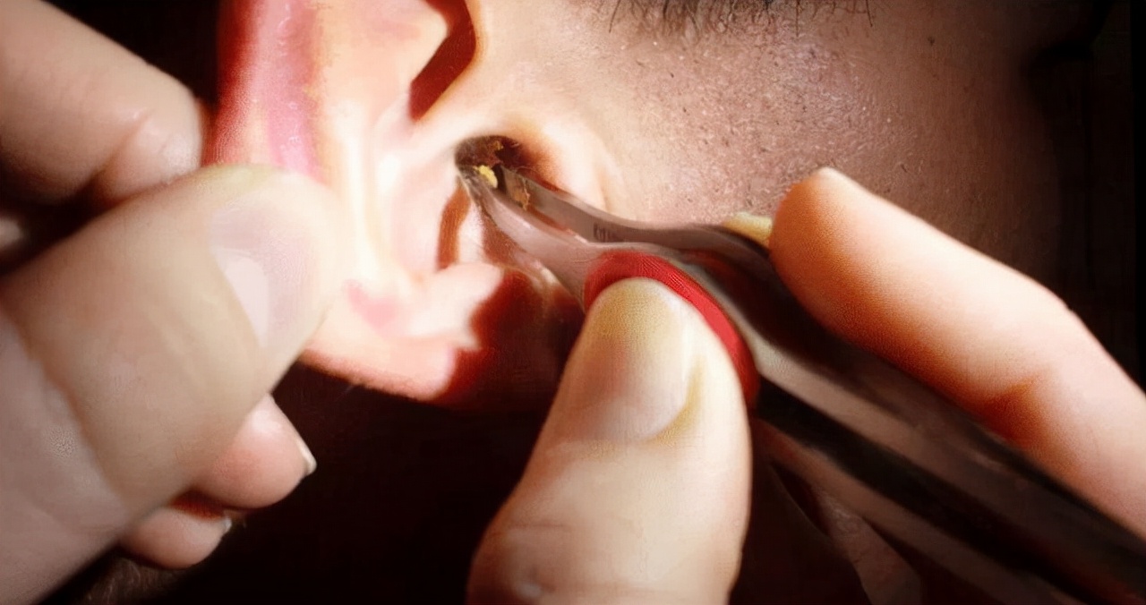 耳朵老是痒,却掏不出任何东西,别忽视,或是这5种疾病的信号