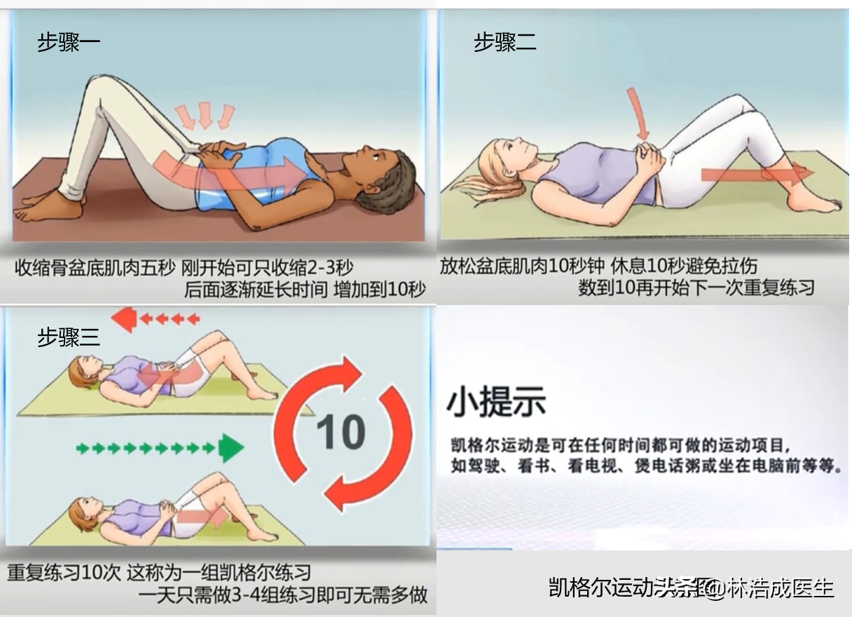 凯格尔训练(提高性功能的锻炼方法——凯格尔运动)