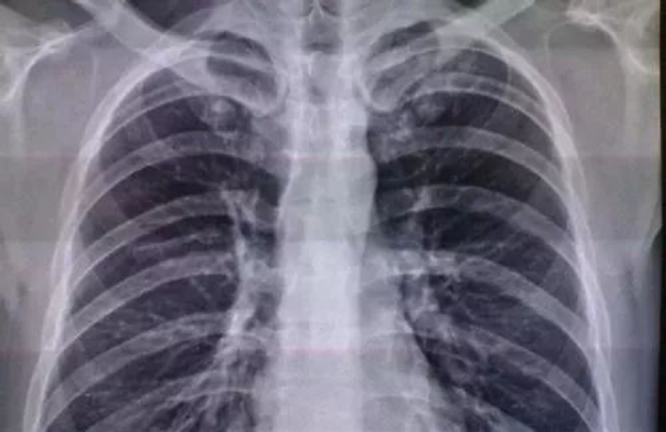 医学专业排名变化很大，快来看看你的专业排在哪里？