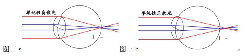 眼镜框架什么材质好，网上眼镜选购指南？