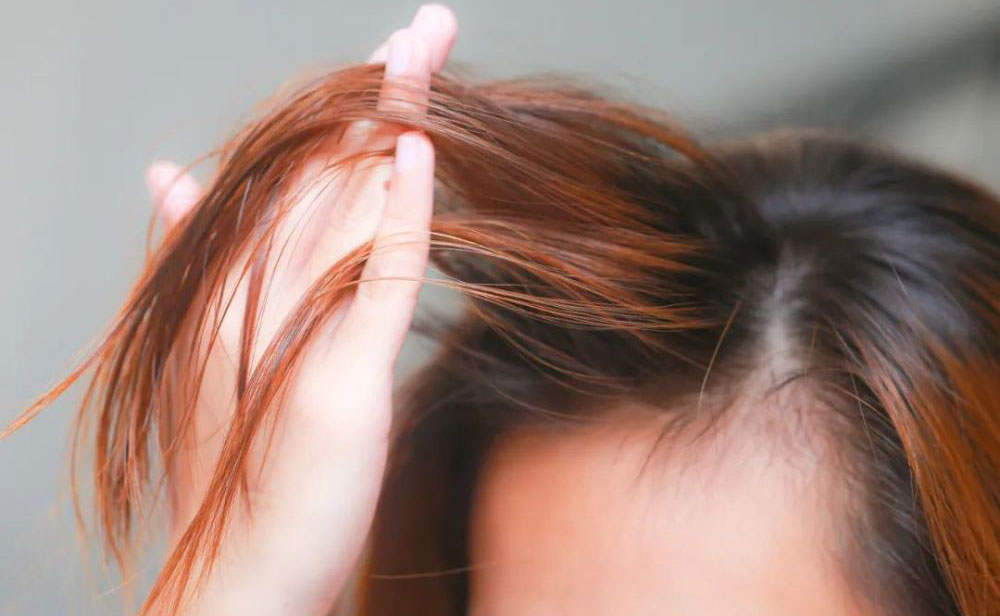头发细软稀少怎么办？天生还是后天因素导致的？