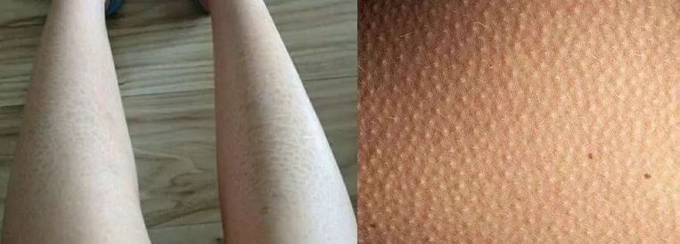 涂身体乳vs不涂身体乳，不仅皮肤差距大，原来“毛发”也跟着长