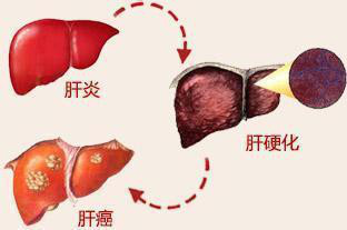 凡是说这7种疾病能根治的，都是骗子！别再上当了