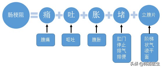 肠梗阻的诊断和治疗