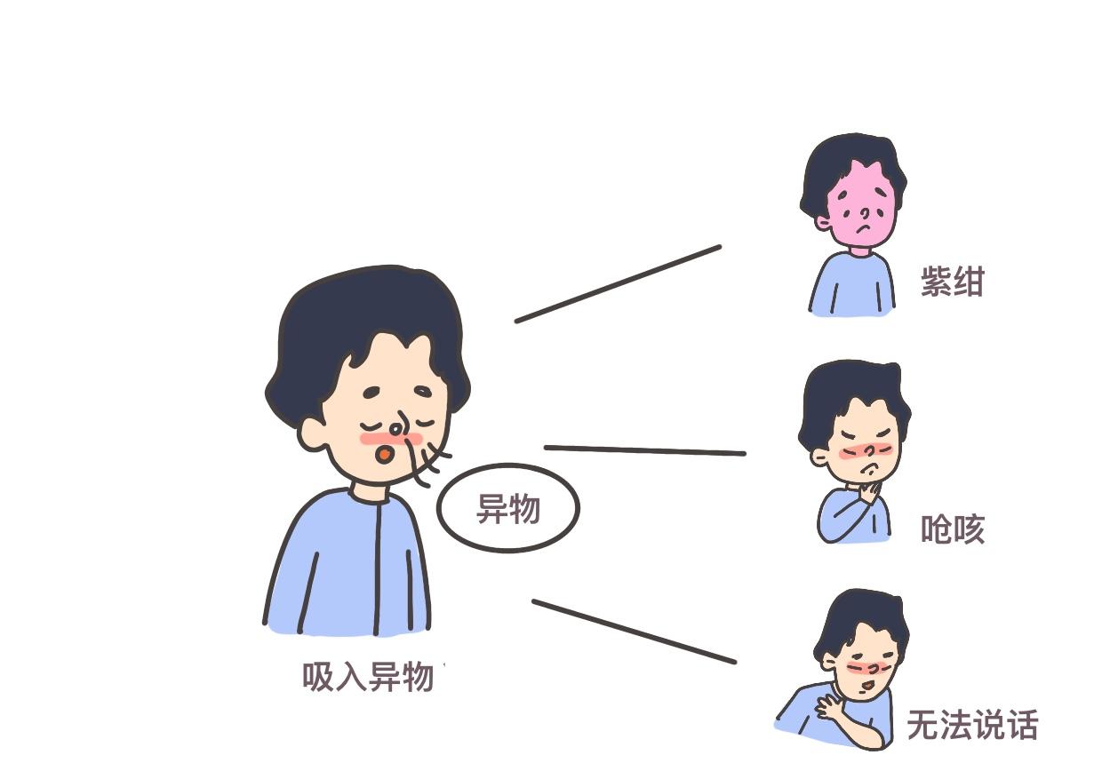 海姆立克急救法的详细步骤（超详细图解）