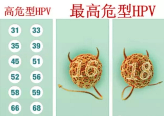 做hpv檢查多少錢7成以上女性都會感染的hpv病毒