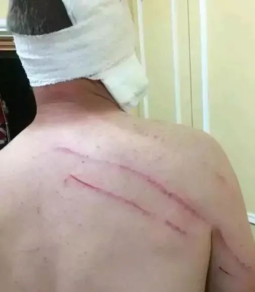 火遍全网的冠军同款袋鼠摇手很可爱？可别被袋鼠的外表欺骗了