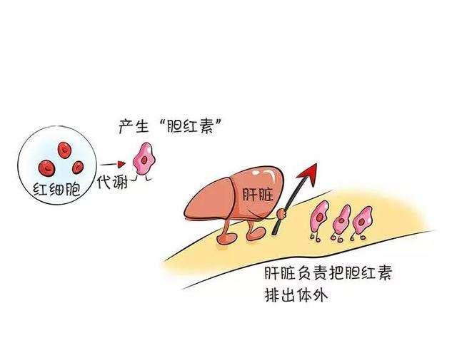 正常的大便为什么是黄色的？黑色，红色，绿色的大便是什么疾病？