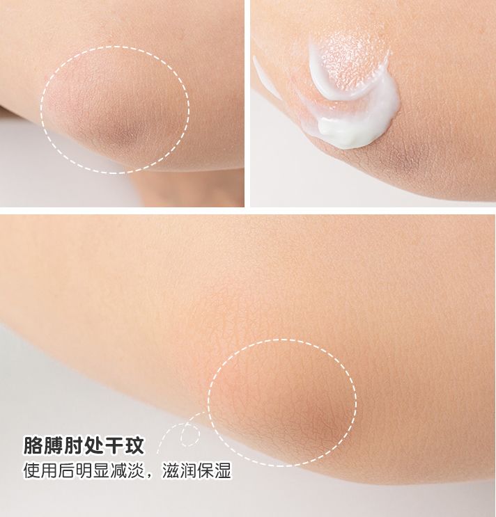 涂身体乳vs不涂身体乳，不仅皮肤差距大，原来“毛发”也跟着长