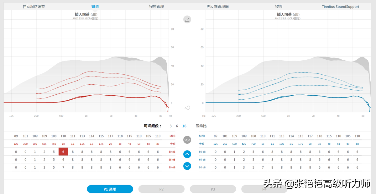 几百元和几千元的助听器差很多吗？一对比，你就知道选哪个不吃亏