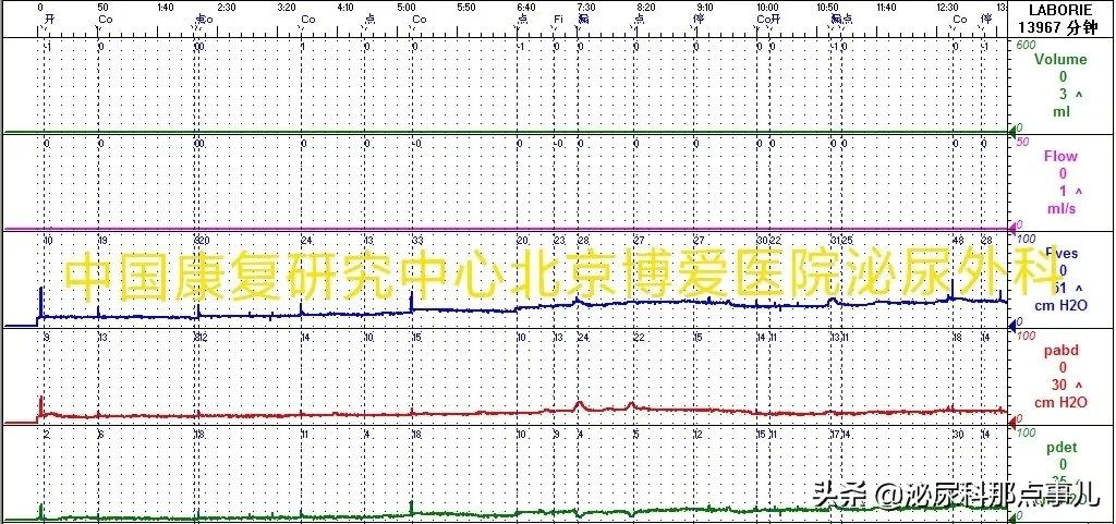 肠道膀胱扩大典型病例解析 | 神经源性下尿路功能障碍专栏 027