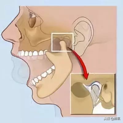 男人下巴中间有个凹陷(王源吃惊到下巴下颌骨脱位？如果平时心情不开心可能也会中招！)