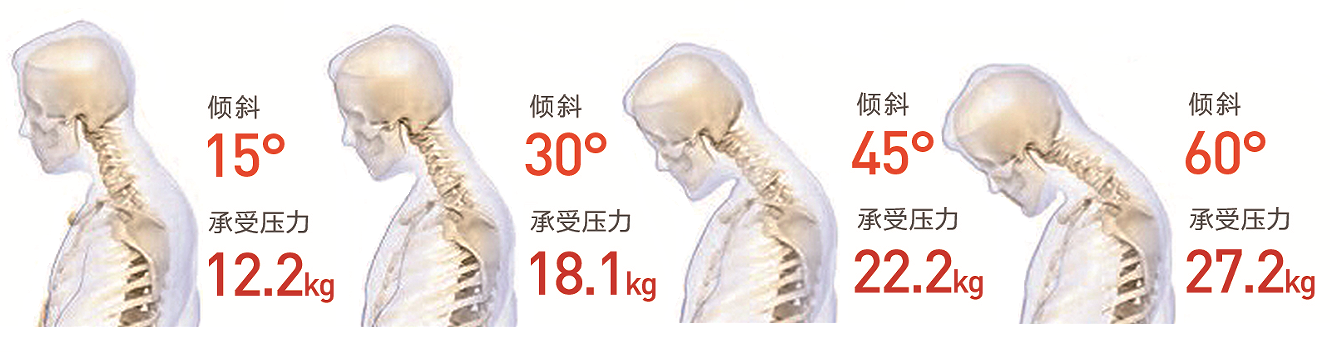 颈椎按摩仪这么选就对了！攀高、SKG两款网红颈椎按摩仪深度对比