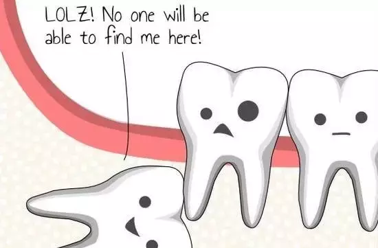 拔智齿价格差别大丨你想知道自己的智齿,拔除需要多少钱吗?