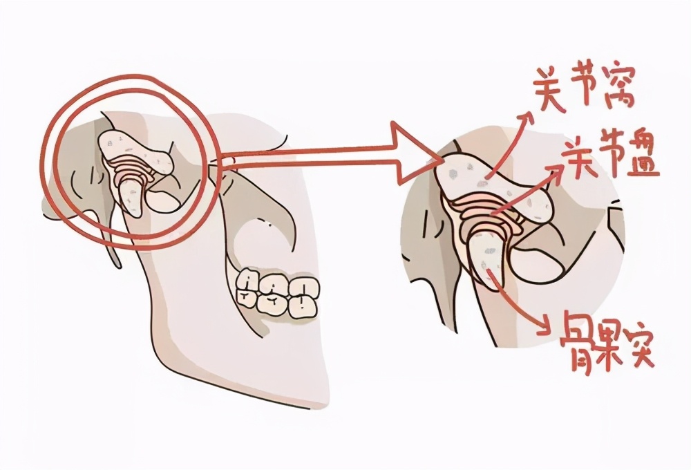 睡觉时磨牙是因为肚子里有虫？专家：注意这3点，千万别忽视