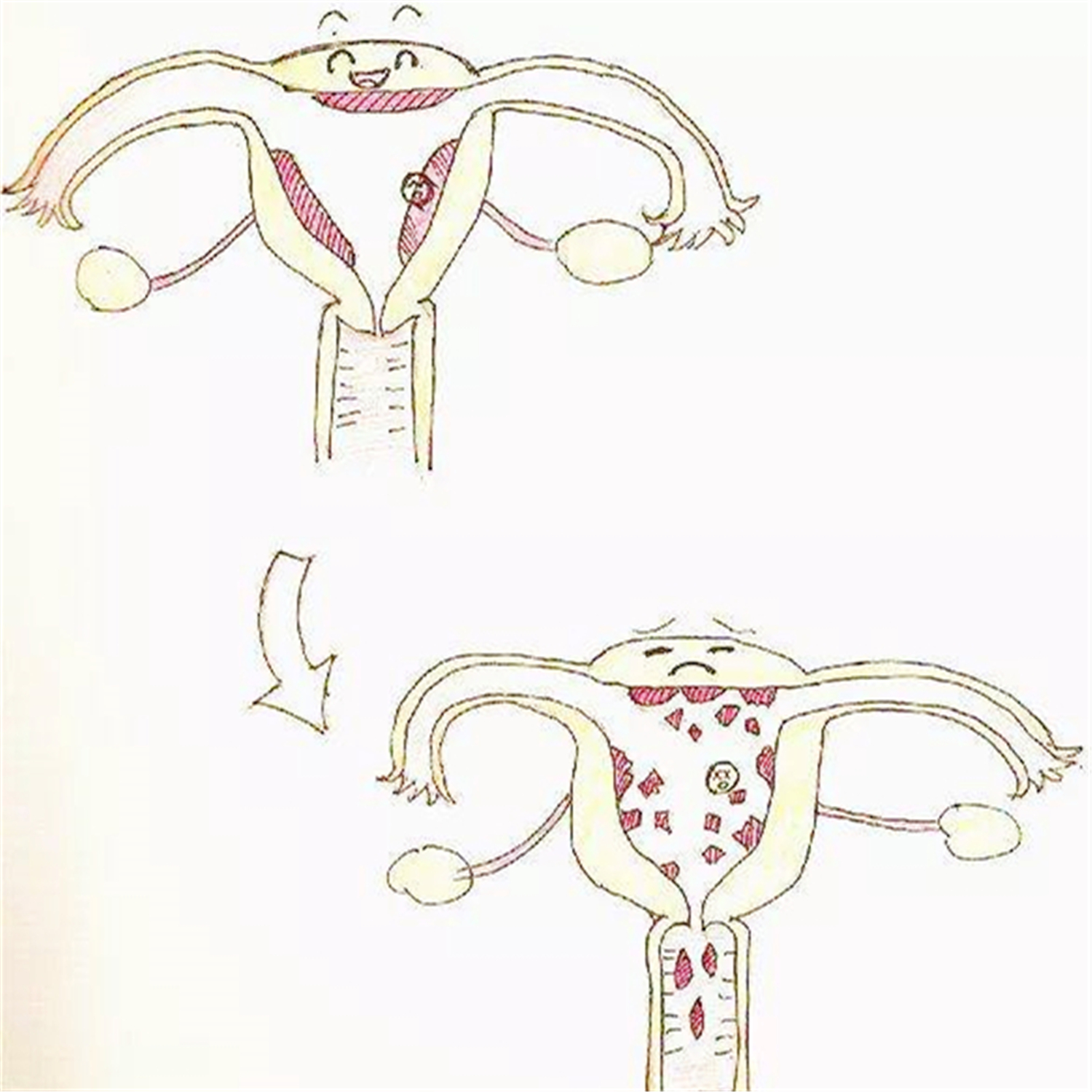 为何用验孕棒测出"两道杠",没过几天月经又来了?是流产了吗?