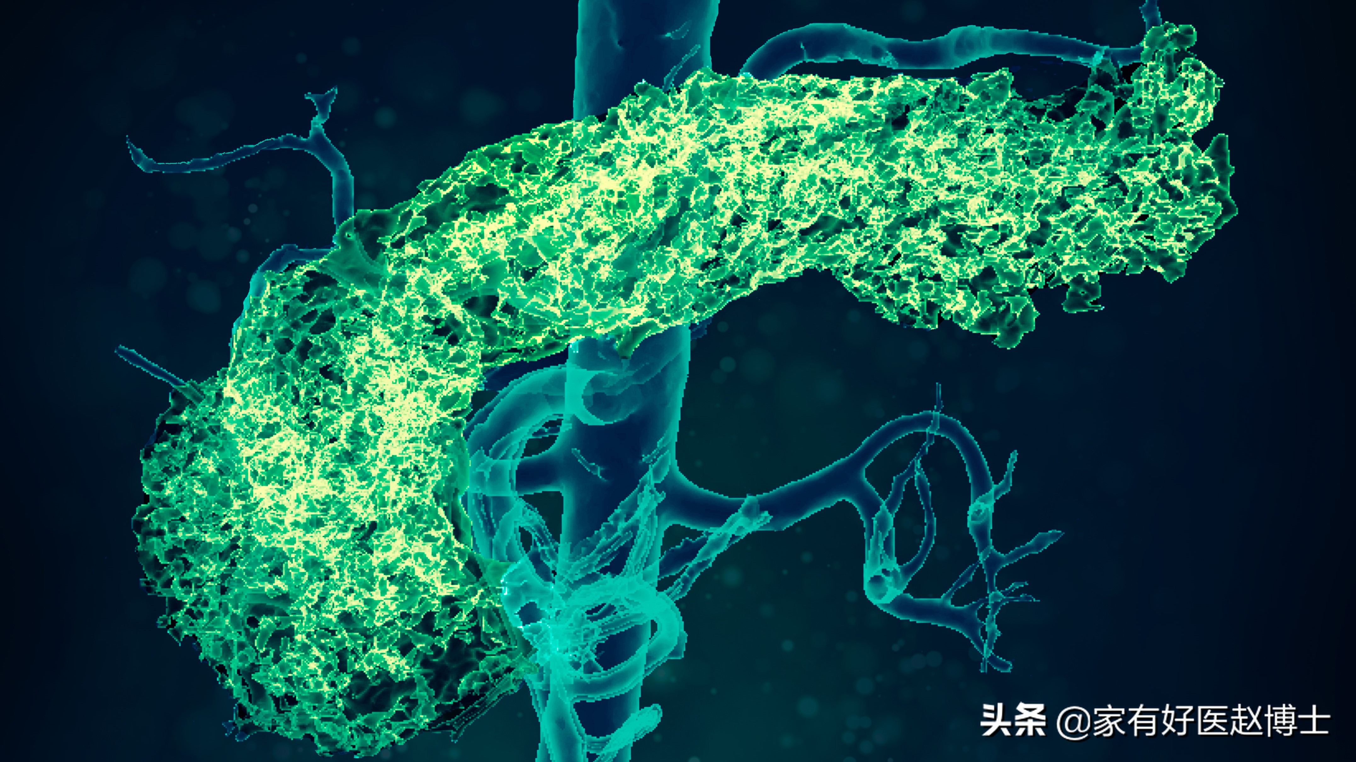 血糖升高，怀疑2型糖尿病？确诊先别急，胰岛免疫筛查别忘记