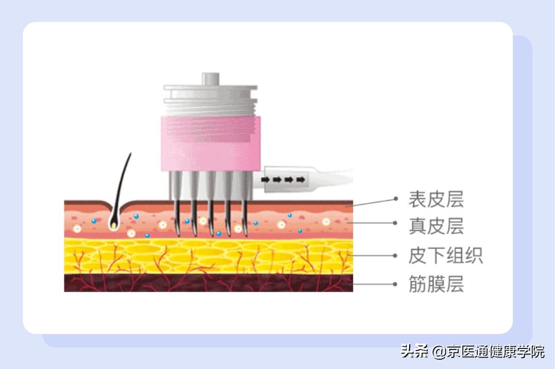 “过敏”“变质风险”的菲洛嘉到底应不应该打，权威科普现状