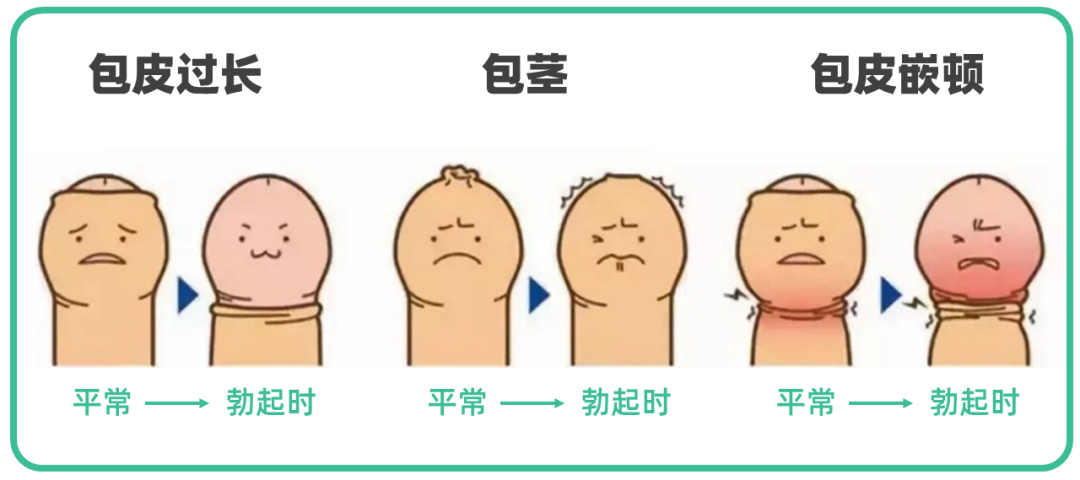 包茎则是不光穿了高领毛衣,还是个领口又窄又紧的高领毛衣,使劲儿抻都