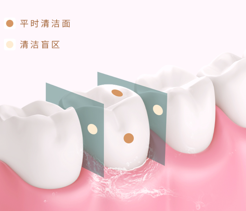 若舒糖果冲牙器体验，牙齿清洁强迫症，这次终于有救了