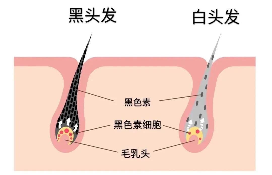 黑头发和白头发中的毛囊对比不同的人拥有的毛囊数量是不同的,每个人