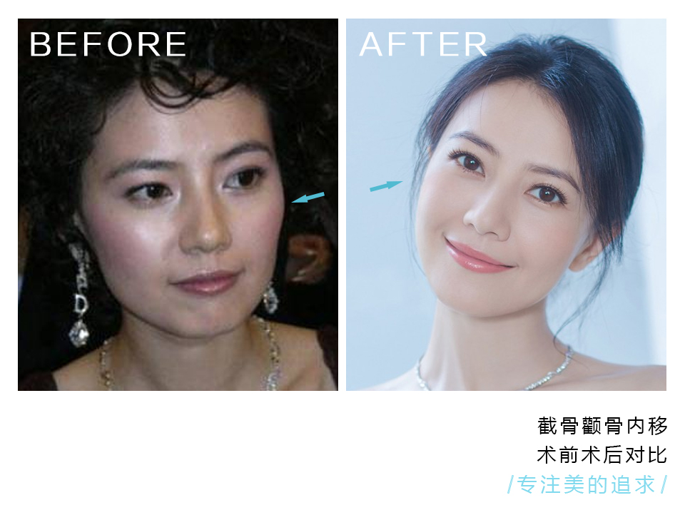 我的脸很大，但咬肌小，要如何瘦脸？