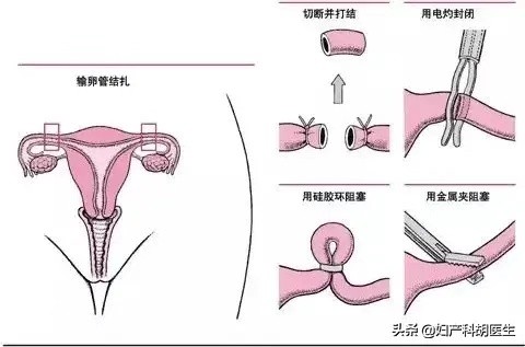 预防“中奖”的方法，最靠谱的都在这