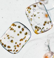 奇趣照片：显微镜下的一滴海水及一滴眼泪