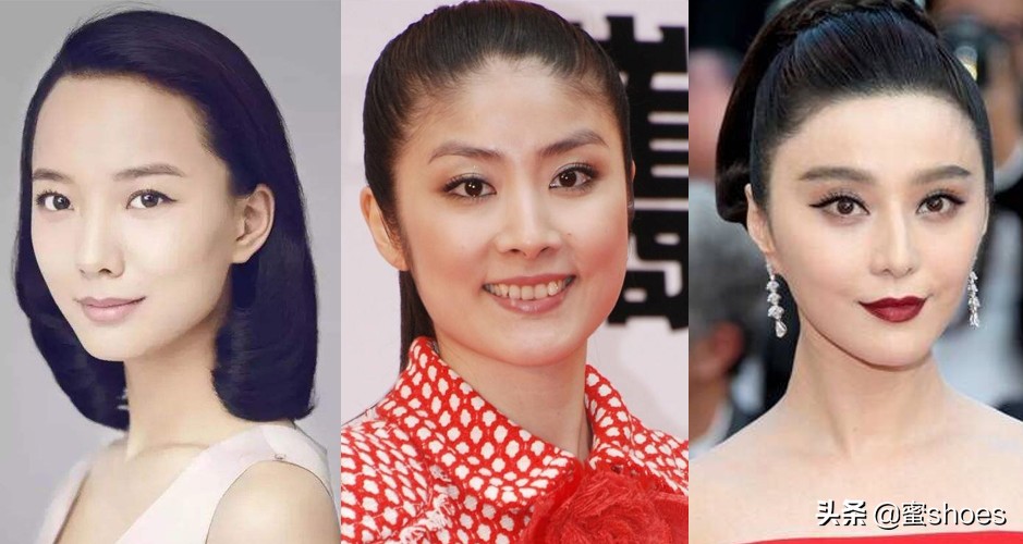 不住发际线的暴击:发际线高不仅显得发量少,还把低颅顶暴露得明明白白