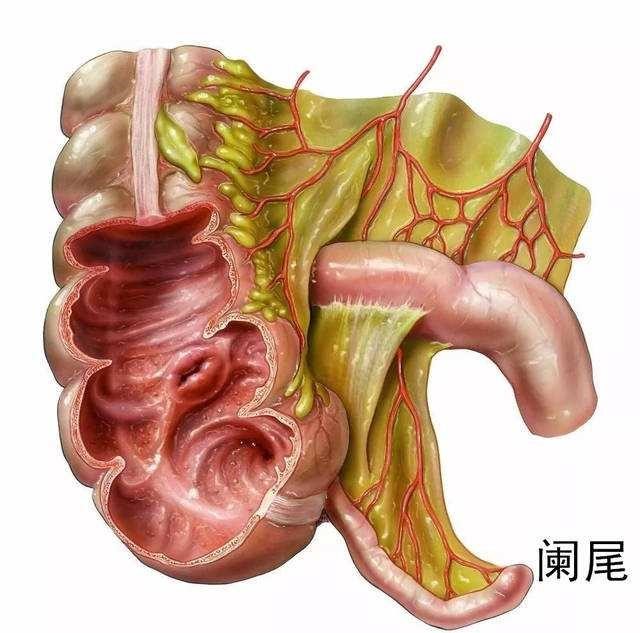 急性阑尾炎一定要手术吗?选择开刀？还是腹腔镜手术?