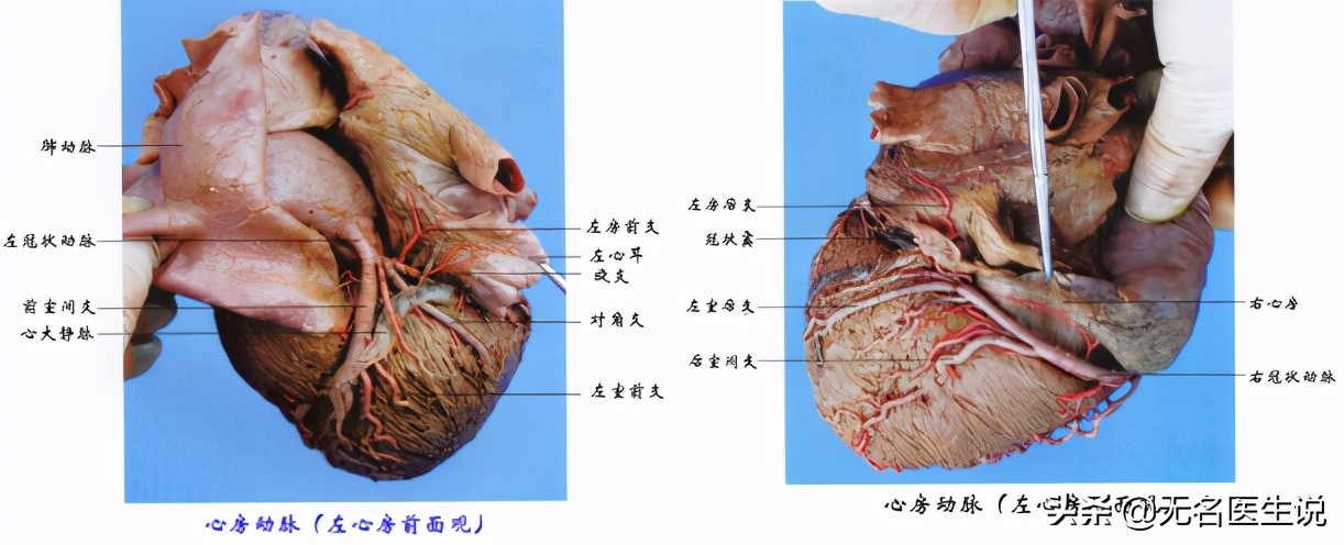 冠心病的解剖基礎——最全的冠脈血管圖解